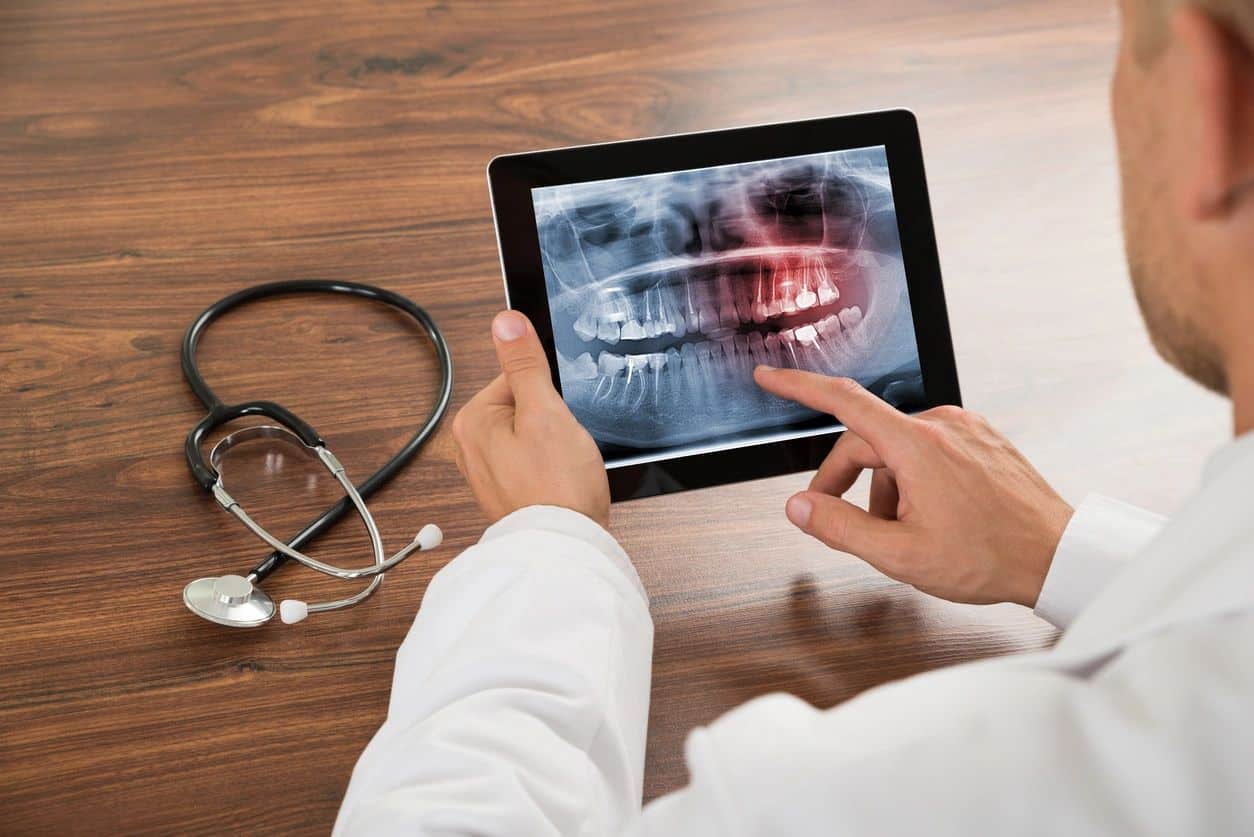 tooth abscess