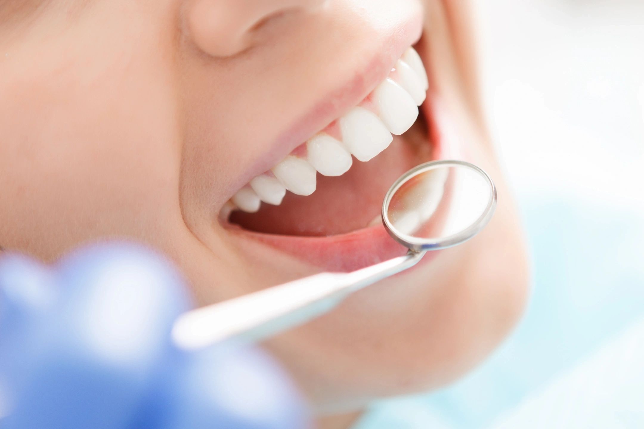 a woman smiling with a small dental mirror in front of teeth